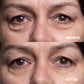 Liftique™ Ultimate Smoothing Set